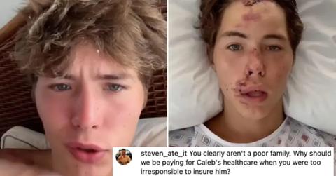 tiktoker caleb coffee before and after hiking accident