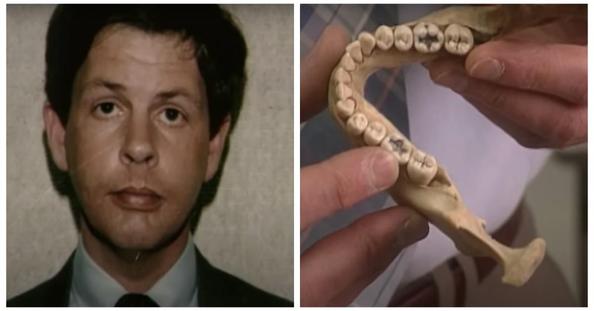 (L-R): Herb Baumeister; jaw from one of Herb Baumeister's victims