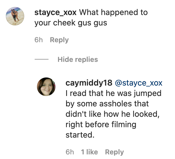 gus scar ig