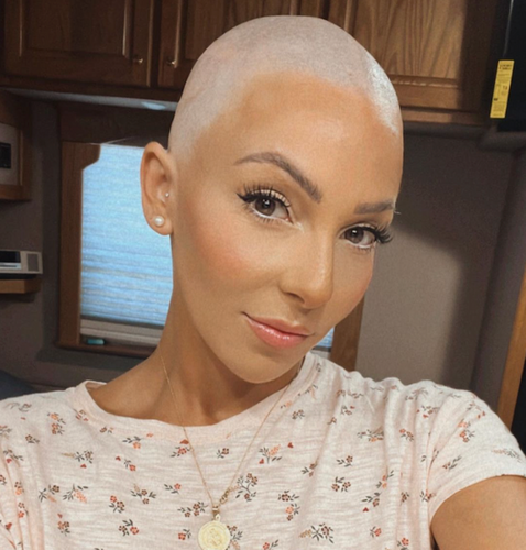 Lizzy musi shaved head