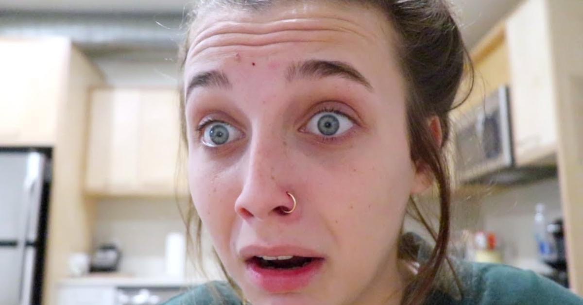 Emma Chamberlain on How to Treat Cracked Lips While on Accutane