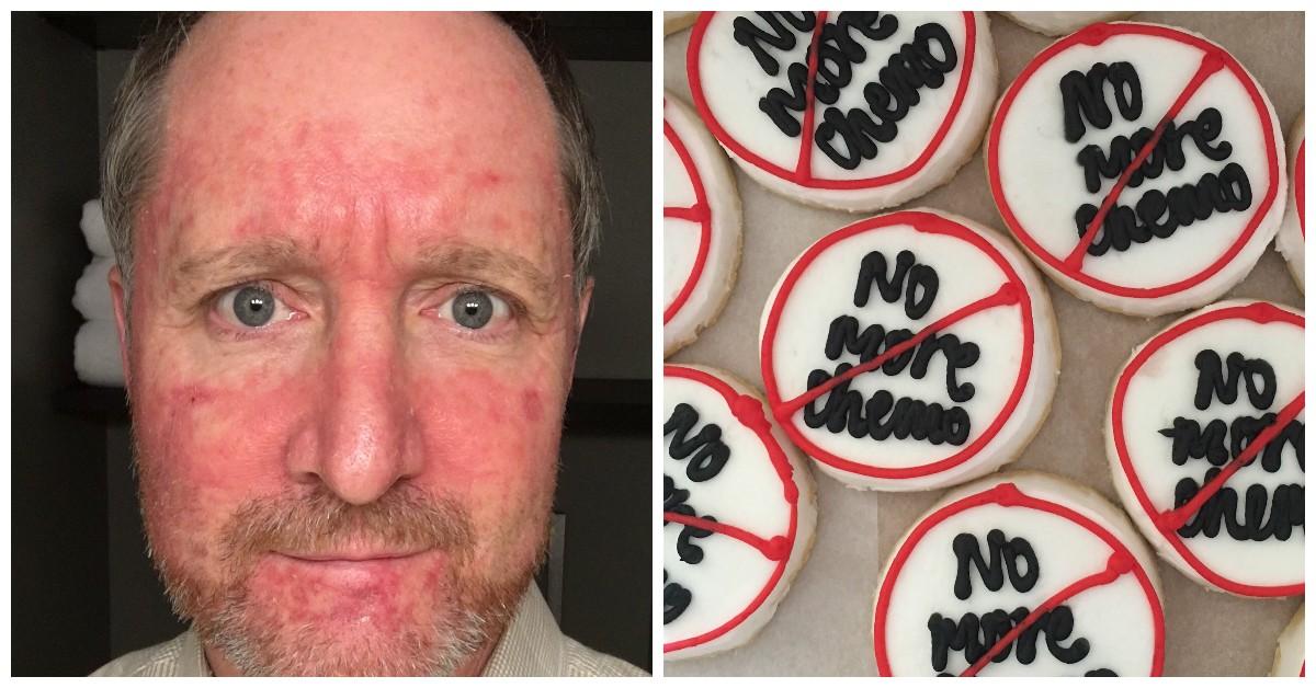 Ian Leonard in 2019 after several rounds of chemo / no more chemo cookies