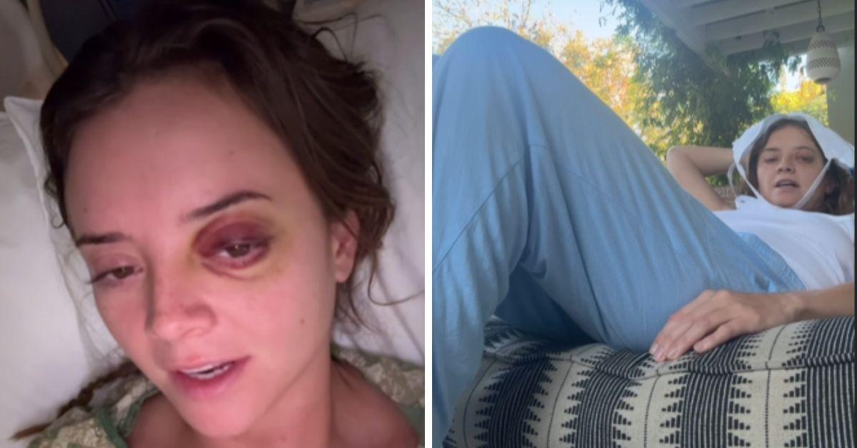 What Happened to Susi Vidal? Influencer Details Her Horrible Accident