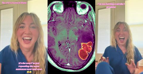 Woman Gets Aphasia During Migraine, Records Her Attack
