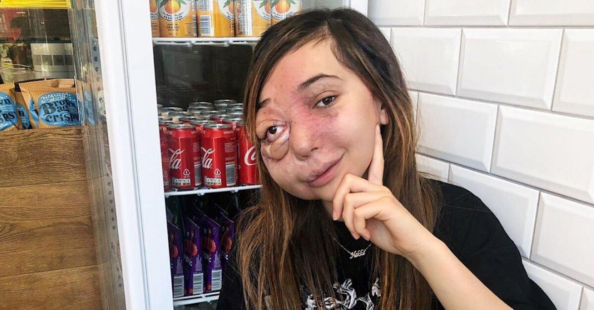 YouTuber Nikki Lilly’s Facial Abnormality Is the Least Interesting Thing About Her!