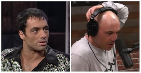 Joe Rogan Talks Failed Hair Transplant