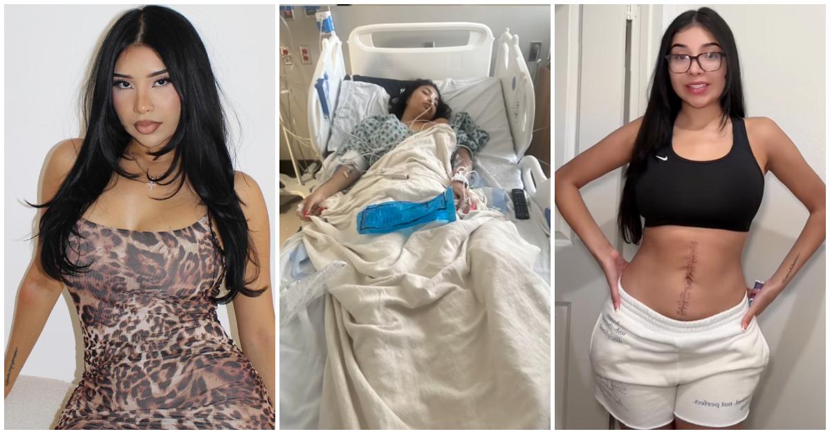 Elsy Guevara before and after accident