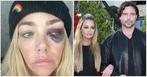 (l-r): Denise Richards, Denise Richards and Aaron Phypers