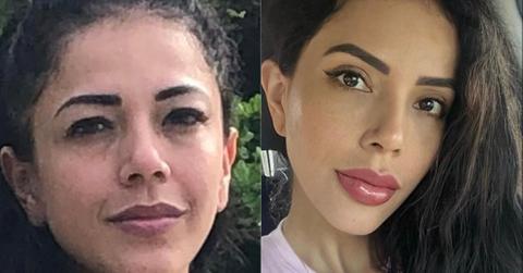 Jasmine Pineda before and after plastic surgeries