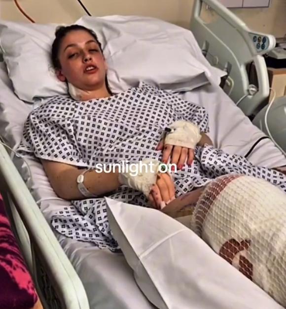 Milly Pickles in her hospital bed pre-amputation
