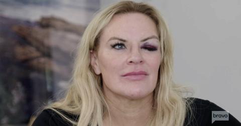 Heather Gay's Black Eye on 'RHOSLC': What Happened?