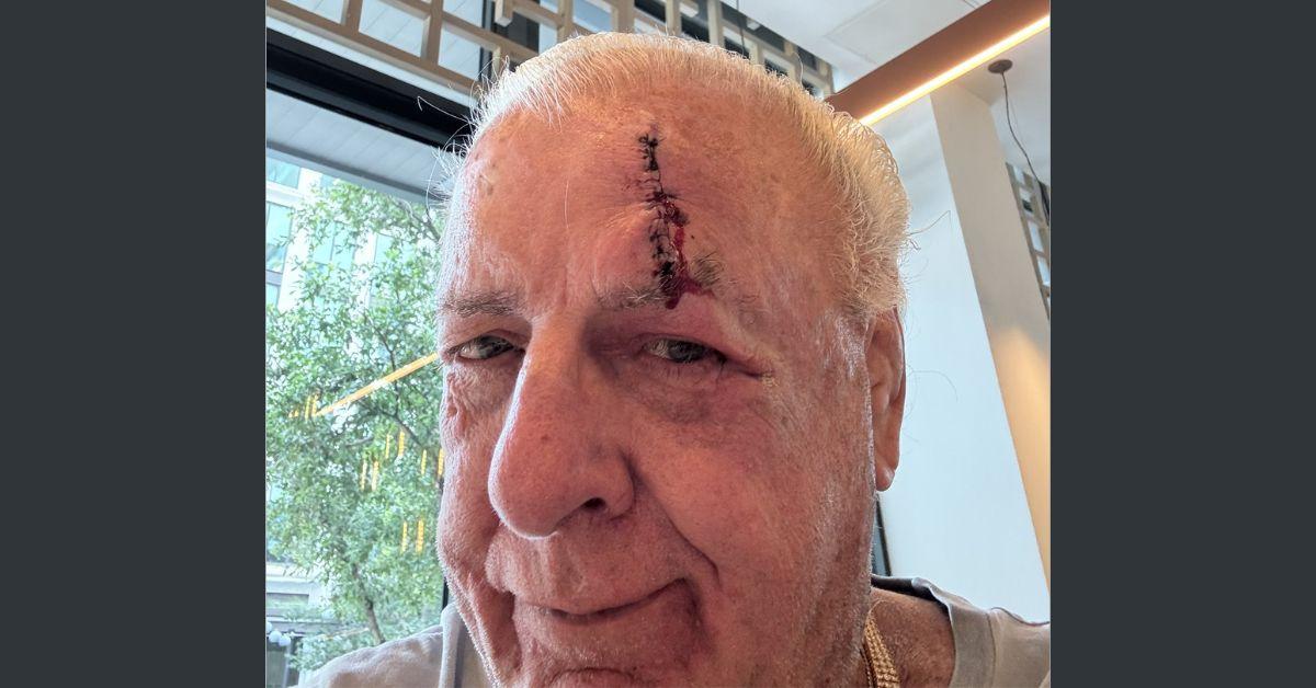 Ric Flair showing off the gash on his forehead. 