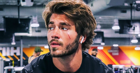 gus floribama shore scar