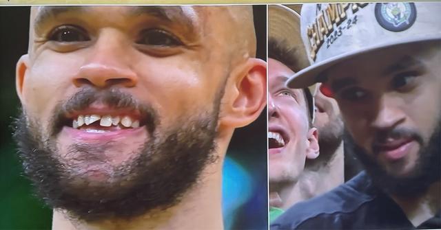 Derrick White flashing his smile during the NBA Finals.