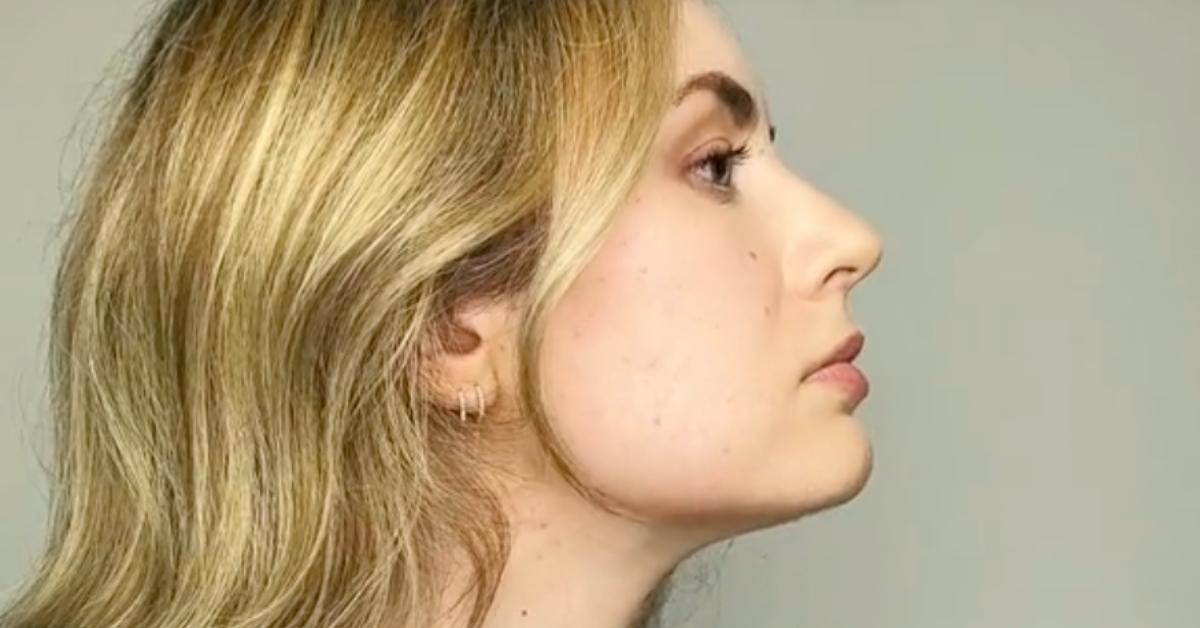 Mewing Side Profile Results - Before/Afters 