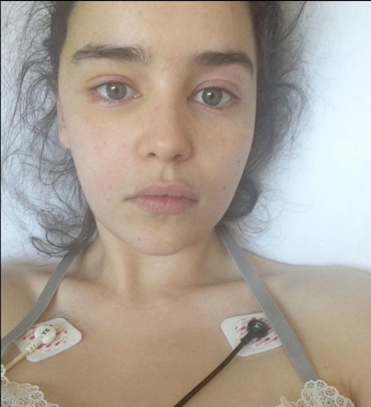 emilia clarke hospital