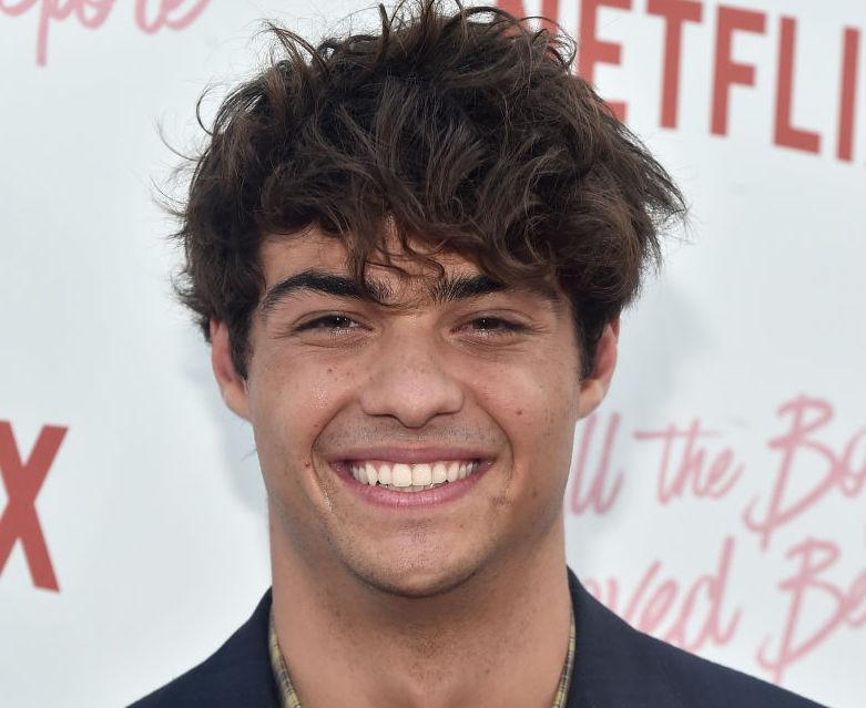 how did noah centineo get his scar