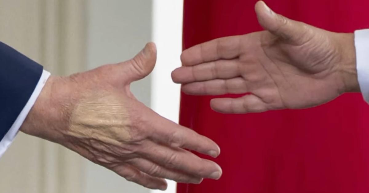 A discolored spot on Donald Trump's hand.