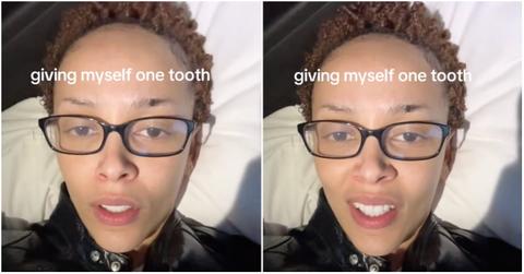 The “Giving Myself One Tooth” TikTok Trend — Who Did It Best?