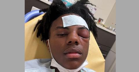IShowSpeed in a hospital bed with his eye swollen shut.