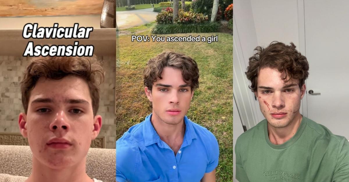 Clavicular Before and After His Looksmaxxing Transformation