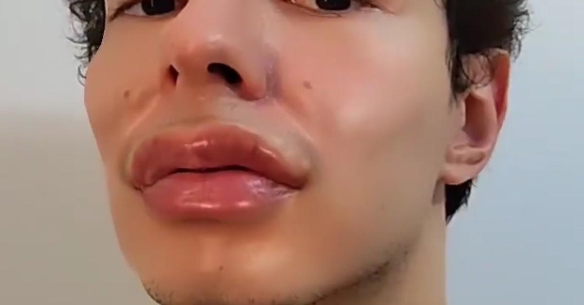 What Is the Pillow Face Filter on Instagram? Users Want to Know