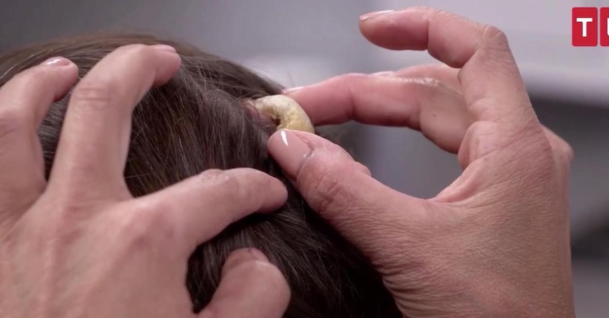 dr pimple popper horn