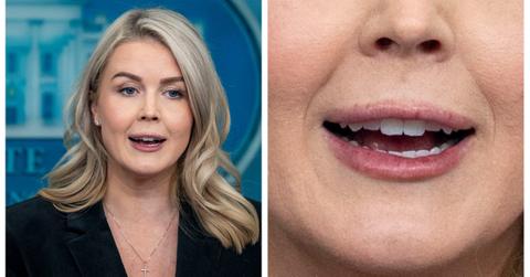 It's Hard to Miss Karoline Leavitt's Lip Fillers in Vanity Fair