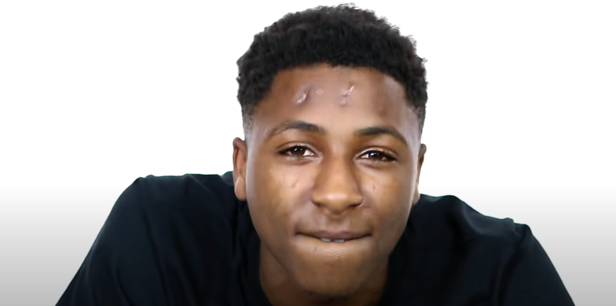 What Happened to NBA Youngboy's Head? Here's How the Rapper Got Those Scars