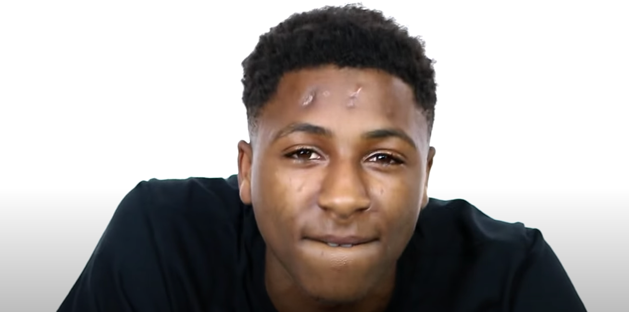 What Happened To NBA YoungBoy's Forehead? Unpacking The Story Behind The Scar