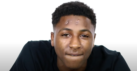 what happened to nba youngboy head