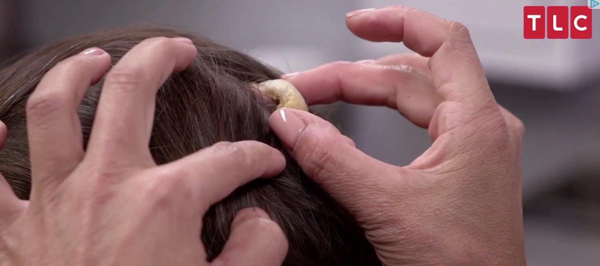 dr pimple popper horn