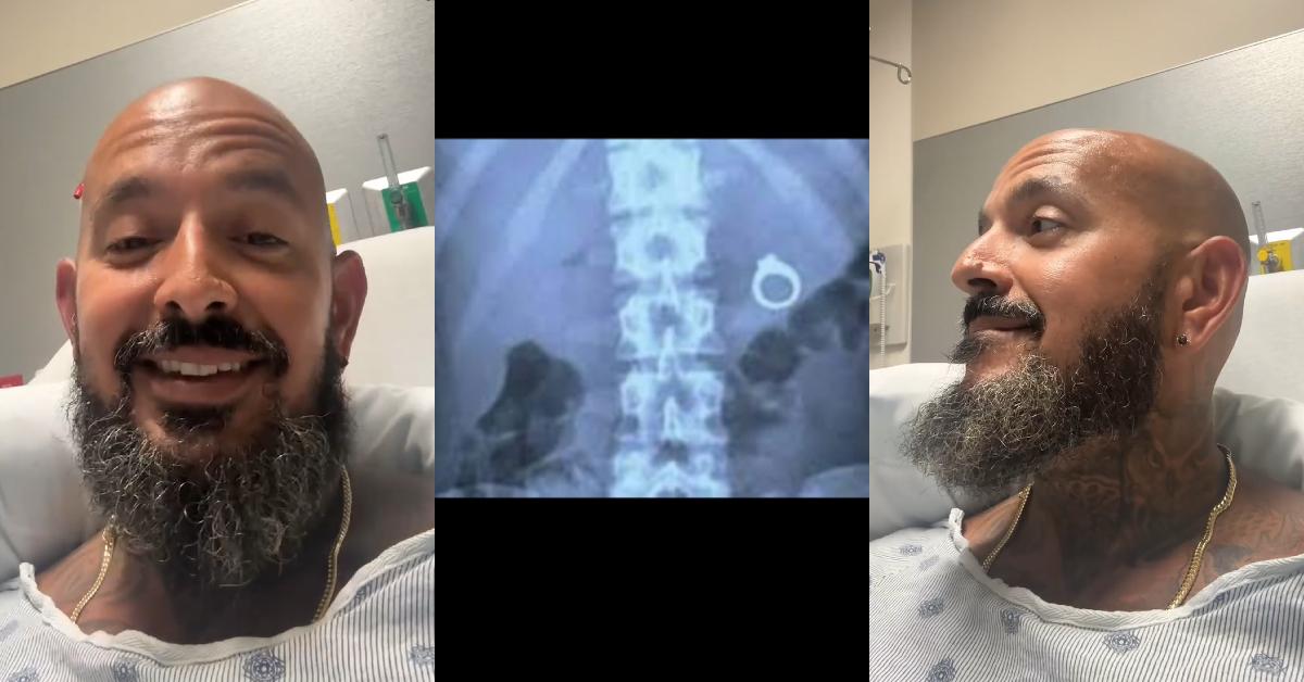 Jeweler Accidentally Swallows Ring Before Wedding