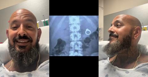 Jeweler Accidentally Swallows Ring Before Wedding