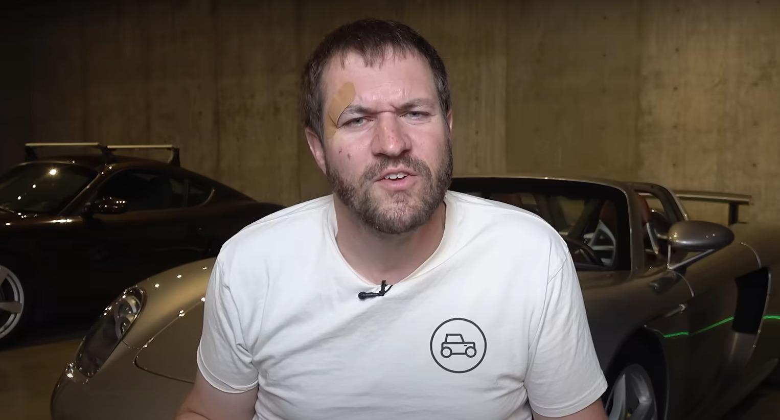 Doug DeMuro Face Injuries Due To Unknown Accident