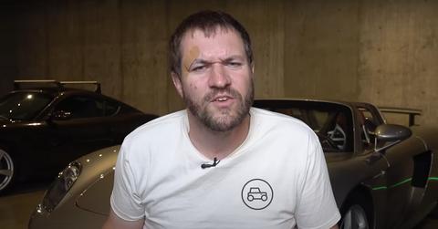 Doug DeMuro Face Injuries Due To Unknown Accident