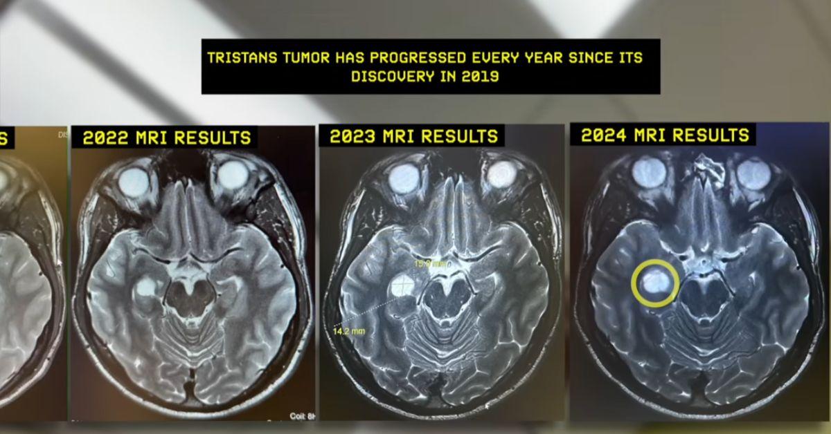 Tristan Jass's Brain Scans